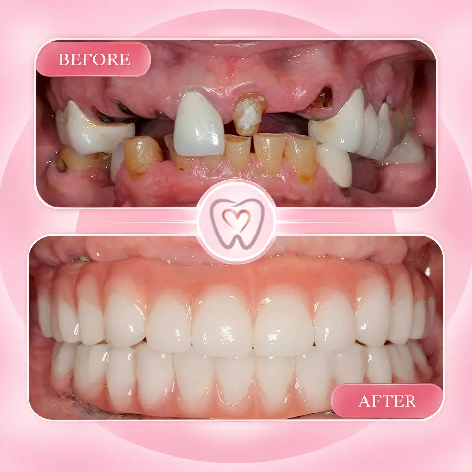 Dental implant procedure